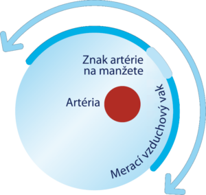 bezna manzeta