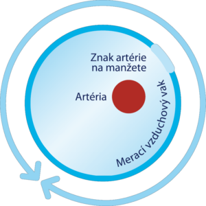 intelli manzeta
