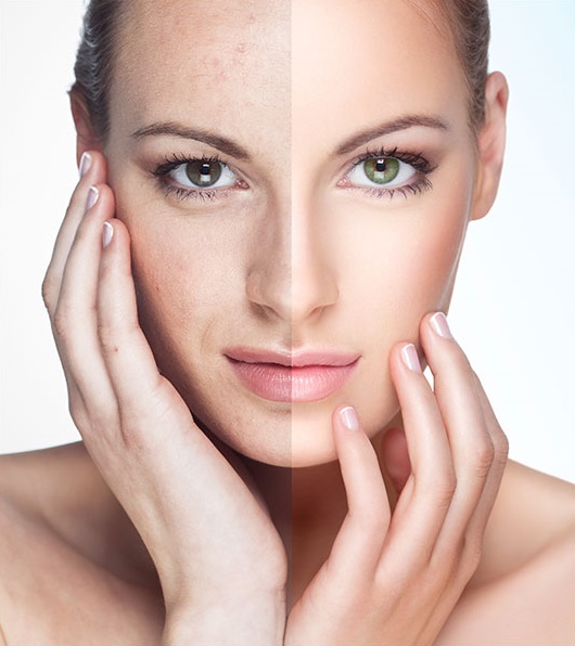 anti-aging efekt, hydratacia pokozky