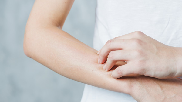 Skin-cap spray, kožné ochorení, suchá koža, ekzém, upokojuje svrbenie, pocit úľavy, Pri svrbení, podráždení, ekzém, dermatitída