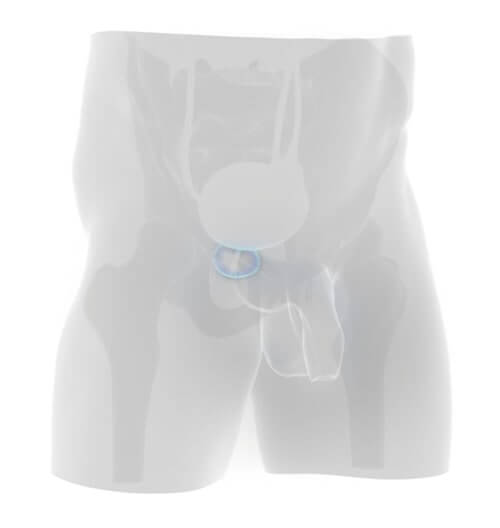 prostenal, zväčšená prostata