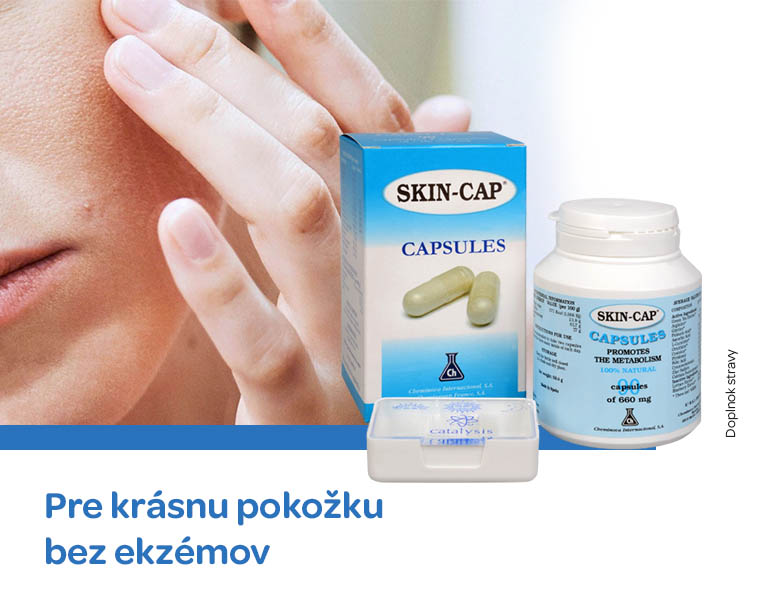 ekzem
