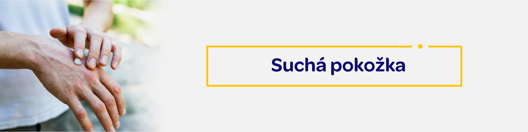 suchá pokožka